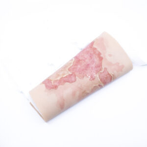 TRAUMASIM Wearable Large Burn - Upper Leg